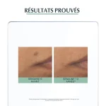 EUCERIN DERMOPURE TRIPLE ACTION SERUM