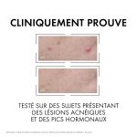 Vichy Normaderm Sérum Anti-imperfections PROBIO-BHA. Peau Grasse Acnéique | 30ml